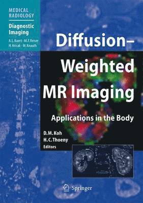 Diffusion-Weighted MR Imaging 1