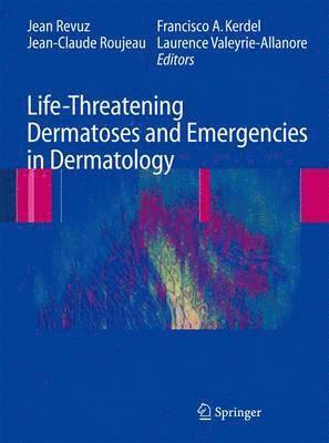 Life-Threatening Dermatoses and Emergencies in Dermatology 1