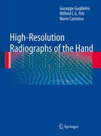 bokomslag High-Resolution Radiographs of the Hand