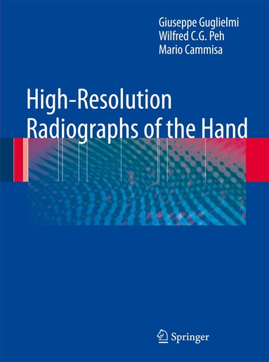 Giuseppe Guglielmi, Wilfred C. G. Peh, Mario Cammisa - High-Resolution Radiographs of the Hand, Inbunden