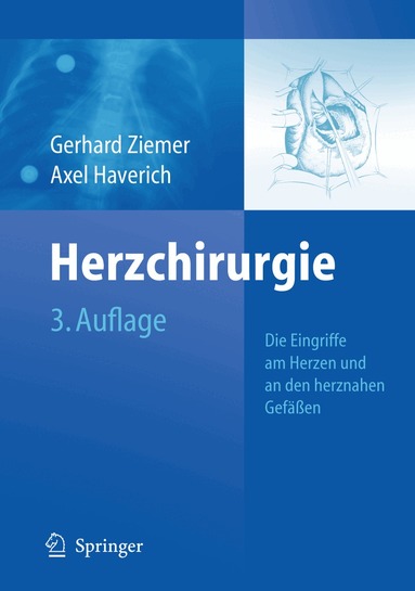 Gerhard Ziemer, Axel Haverich - Herzchirurgie, Inbunden