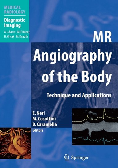 bokomslag MR Angiography of the Body
