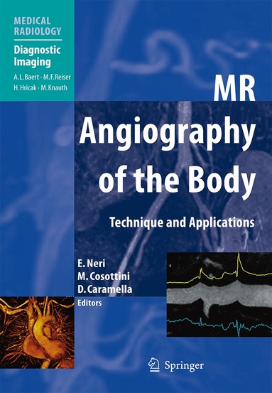 bokomslag MR Angiography of the Body