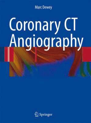 bokomslag Coronary CT Angiography