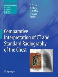 bokomslag Comparative Interpretation of CT and Standard Radiography of the Chest