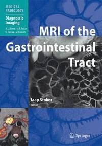 bokomslag MRI of the Gastrointestinal Tract