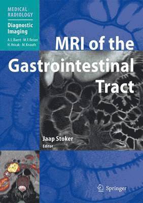 Jaap Stoker - MRI of the Gastrointestinal Tract, Inbunden