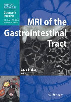 MRI of the Gastrointestinal Tract 1