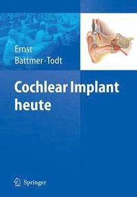 bokomslag Cochlear Implant heute