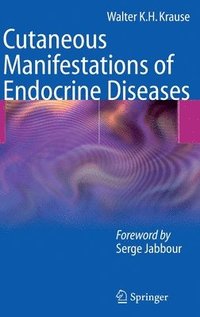 bokomslag Cutaneous Manifestations of Endocrine Diseases