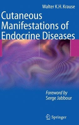 Cutaneous Manifestations of Endocrine Diseases 1