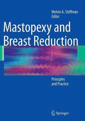 Melvin A. Shiffman, Melvin a. Shiffman - Mastopexy and Breast Reduction, Inbunden