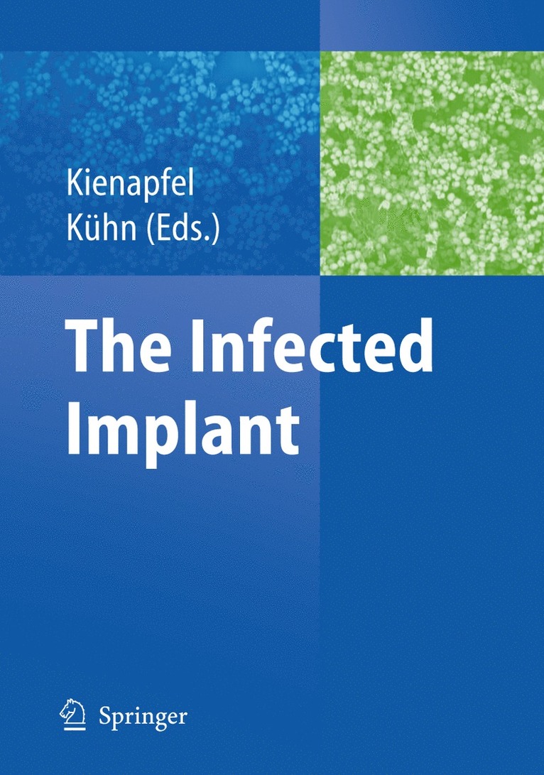 Heino Kienapfel, Klaus-Dieter Kühn - Infected Implant, Häftad