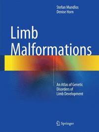 bokomslag Limb Malformations