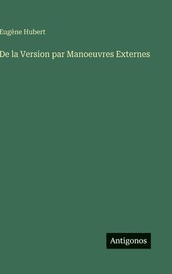 De la Version par Manoeuvres Externes