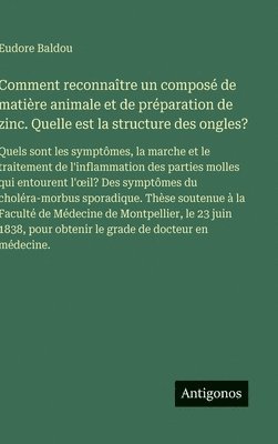 bokomslag Comment reconnaître un composé de matière animale et de préparation de zinc. Quelle est la structure des ongles?:Quels sont les symptômes, la marche e