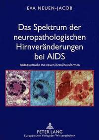 bokomslag Das Spektrum Der Neuropathologischen Hirnveraenderungen Bei AIDS