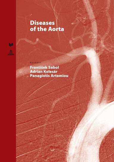 Frantisek Sabol, Adrian Kolesar, Panagiotis Artemiou - Diseases of the Aorta, Inbunden
