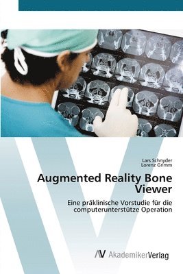Augmented Reality Bone Viewer 1