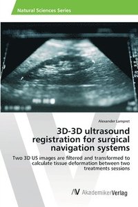 bokomslag 3D-3D ultrasound registration for surgical navigation systems