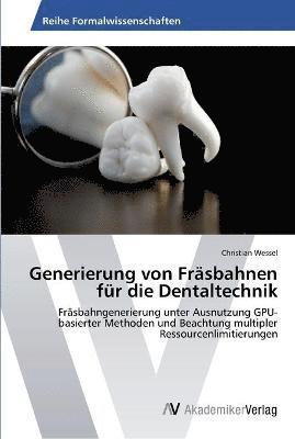 Generierung von Frsbahnen fr die Dentaltechnik 1