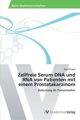 Zellfreie Serum DNA und RNA von Patienten mit einem Prostatakarzinom 1