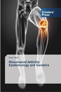 bokomslag Rheumatoid Arthritis