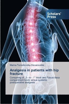 bokomslag Analgesia in patients with hip fracture