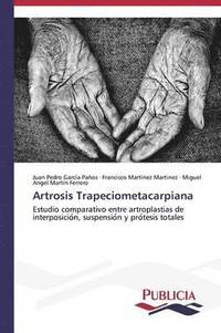 bokomslag Artrosis Trapeciometacarpiana
