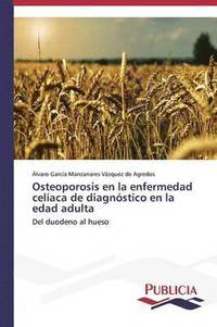 bokomslag Osteoporosis en la enfermedad celaca de diagnstico en la edad adulta