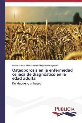 Osteoporosis en la enfermedad celaca de diagnstico en la edad adulta 1
