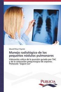 bokomslag Manejo radiolgico de los pequeos ndulos pulmonares