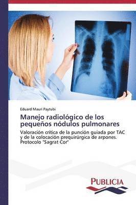 Manejo radiolgico de los pequeos ndulos pulmonares 1