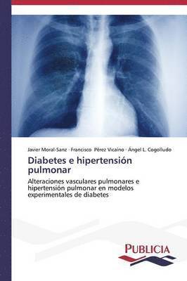 Javier Moral-Sanz, Francisco Pérez Vicaíno, Ángel L Cogolludo, Ángel L. Cogolludo - Diabetes e hipertensión pulmonar, Häftad