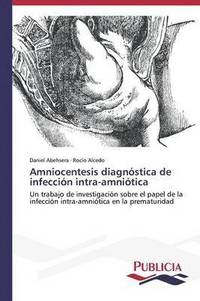 bokomslag Amniocentesis diagnstica de infeccin intra-amnitica