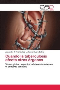 bokomslag Cuando la tuberculosis afecta otros rganos