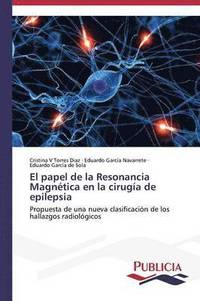 bokomslag El papel de la Resonancia Magntica en la ciruga de epilepsia