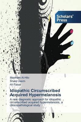 Idiopathic Circumscribed Acquired Hypermelanosis 1