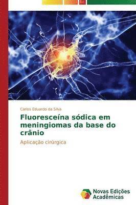 bokomslag Fluorescena sdica em meningiomas da base do crnio