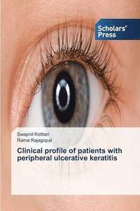 bokomslag Clinical profile of patients with peripheral ulcerative keratitis