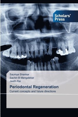 bokomslag Periodontal Regeneration