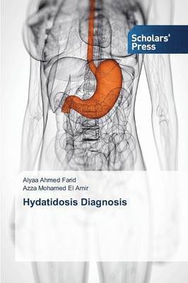 bokomslag Hydatidosis Diagnosis