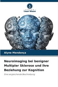 bokomslag Neuroimaging bei benigner Multipler Sklerose und ihre Beziehung zur Kognition