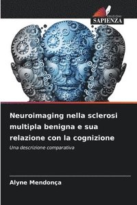 bokomslag Neuroimaging nella sclerosi multipla benigna e sua relazione con la cognizione