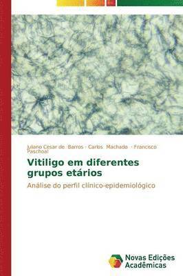 Vitiligo em diferentes grupos etrios 1