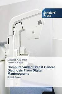 bokomslag Computer-Aided Breast Cancer Diagnosis From Digital Mammograms