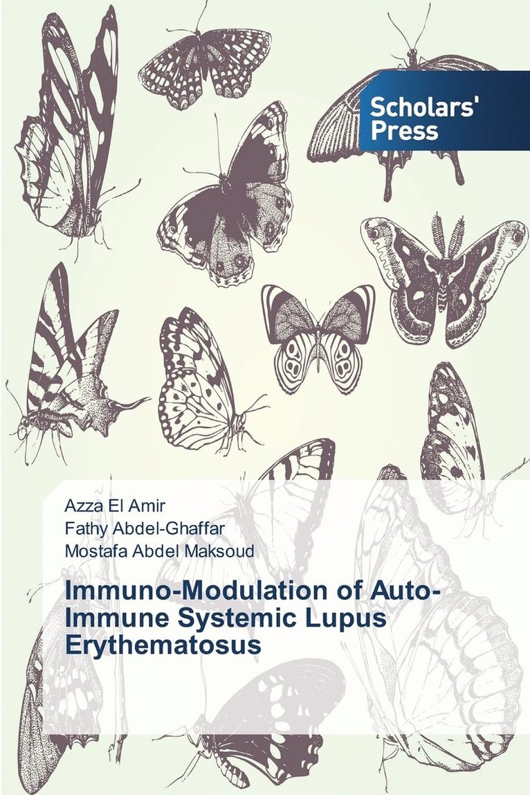 Immuno-Modulation of Auto-Immune Systemic Lupus Erythematosus 1