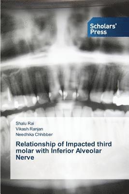 Rai Shalu, Ranjan Vikash, Chhibber Needhika, Shalu Rai, Vikash Ranjan, Needhika Chhibber - Relationship of Impacted third molar with Inferior Alveolar Nerve, Häftad