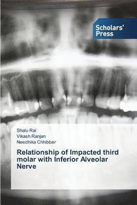 Relationship of Impacted third molar with Inferior Alveolar Nerve 1