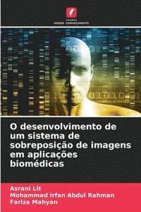 bokomslag O desenvolvimento de um sistema de sobreposição de imagens em aplicações biomédicas